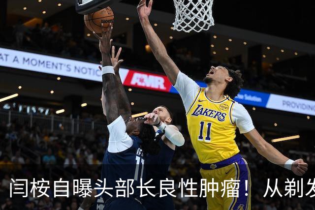 闫桉自曝头部长良性肿瘤！从剃发上手术台到《嫁金钗》播出